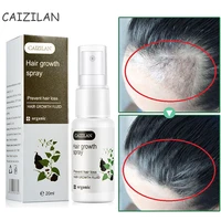 hair growth spray serum effective germinal liquid products scalp treatments prevent hair loss thinning beauty care for men women