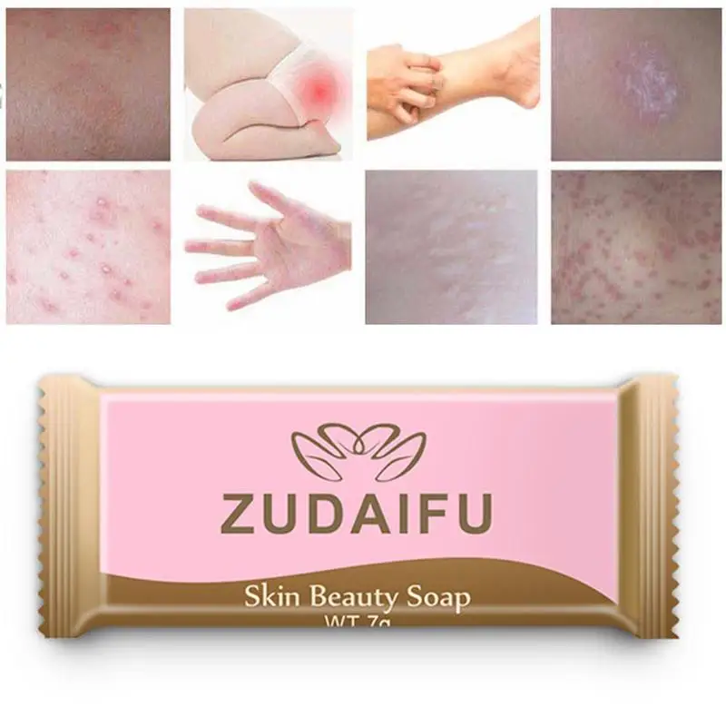 3pcs Zudaifu Bath Whitening Soap Shampoo Sulfur Soap Skin Conditions Acne Psoriasis Seborrhea Eczema Skin Care