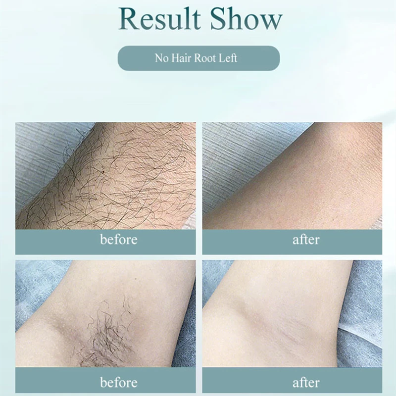 Лазерный эпилятор 9Permanent IPL устройство для удаления волос 900000 вспышек