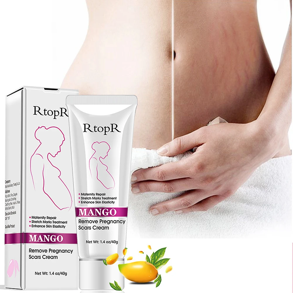 

Mango Remove Pregnancy Scars Acne Cream Stretch Marks Treatment Maternity Repair Anti Aging Anti Wrinkles Firming Body Creams