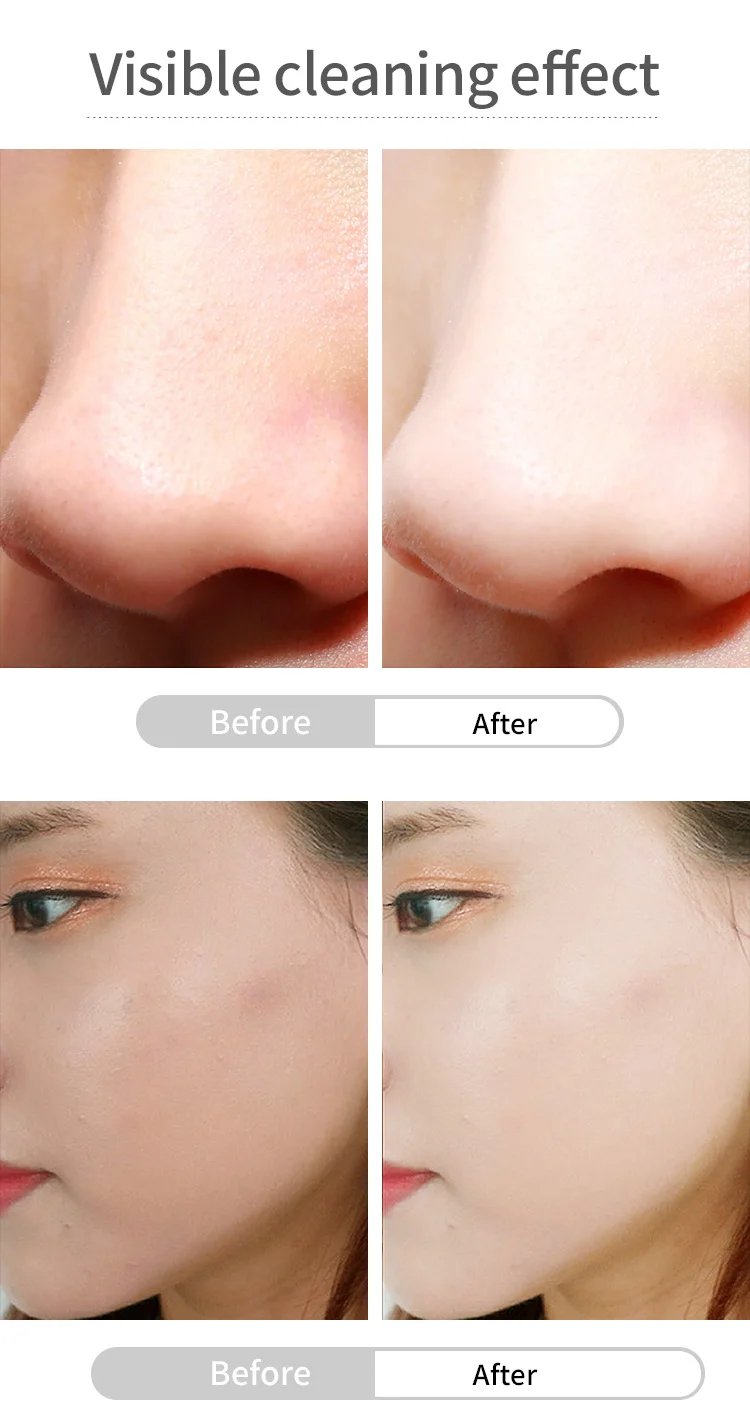 Purifying Cream-Detox Massage Lotion Acne Blackhead Remover Deep Cleasing Balance sebum system and Contract the Skin Pores | Красота и