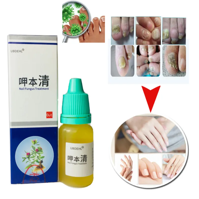 1/2PCS жидкость для лечения онихомикоза паронихии противогрибковые инфекция