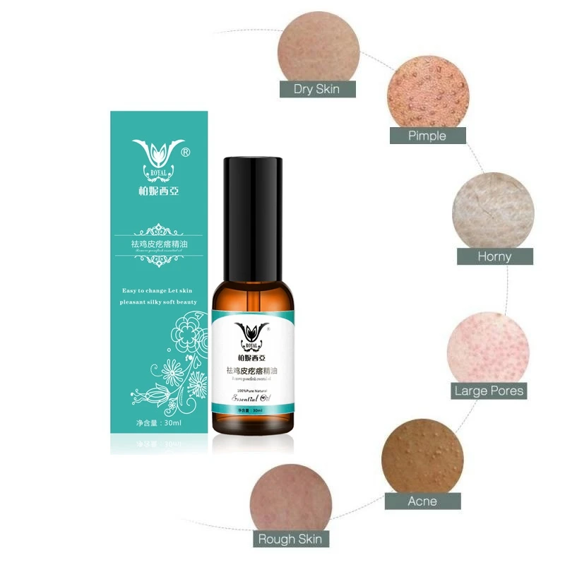 Отбеливающие эфирные масла для курицы 30 мл | Красота и здоровье