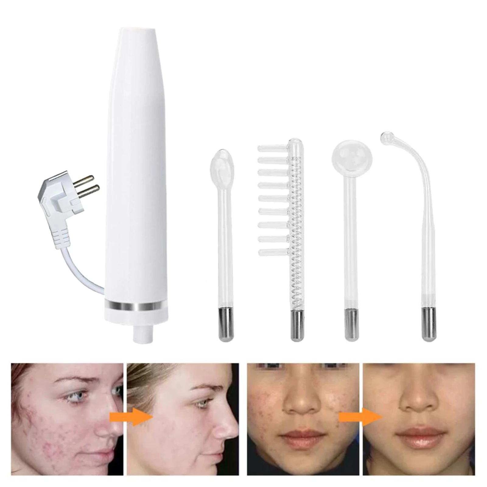 

Электротерапия палочка Стекло трубка высокая частота лице машина акне подтяжки кожи Высокая частота уход за лицом уход за кожей Замена