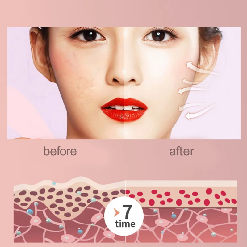 Электрический дермапен микро крошечные иглы Уход за кожей лица терапия удаления