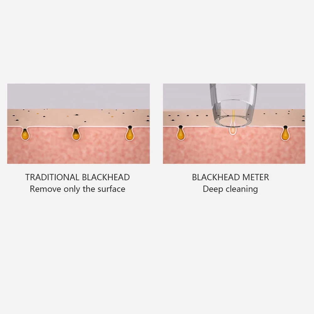 USB средство для удаления черных точек лица вакуумный уход за кожей очиститель пор