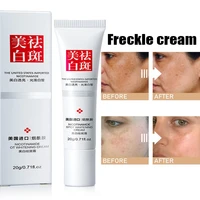 20g effective whitening freckle cream remove melasma acne melanin spot pigment dark spots pigmentation skin care cream