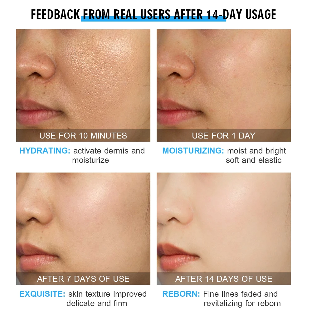 

Acide Hyaluronique Eye Serum Cream Dark Circles Ojeras Eliminacion Antiarrugas Contorno De Ojos Anticerne Pour Les Yeux Olheiras