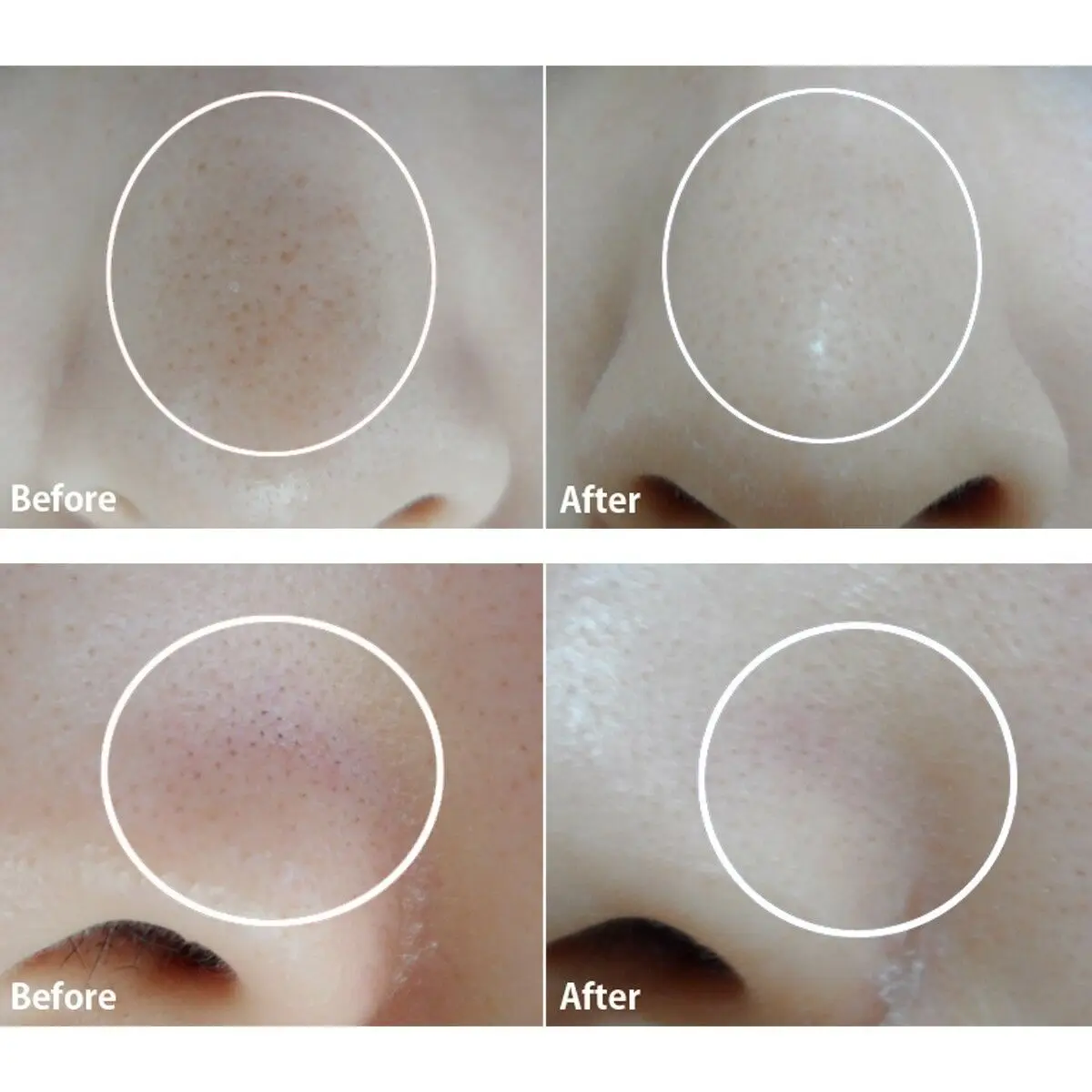 

TONYMOLY Egg Pore Nose Pack 7pcs Powerful Blackhead Remover Mask Acne Treatment Mask Face Care Repair Pimple Korea Cosmetics