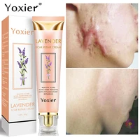yoxier lavender scar repair cream removal acne scar pigmentation corrector remove stretch marks smooth whitening scar skin care