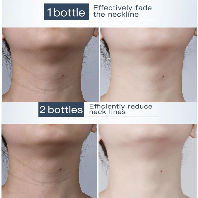 Крем Daralis для шеи против морщин отбеливающий крем сывороточного протеина