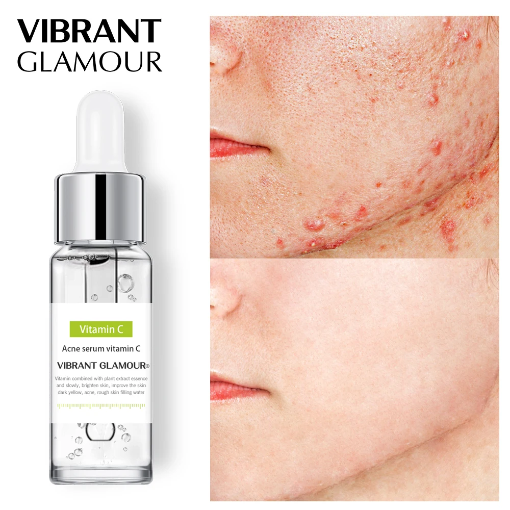 Яркий гламурный счастливый пакет из 3 предметов набор для удаления черных точек