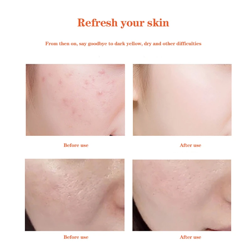 USB-счетчик кислорода портативный воздушный насос высокого давления омоложение