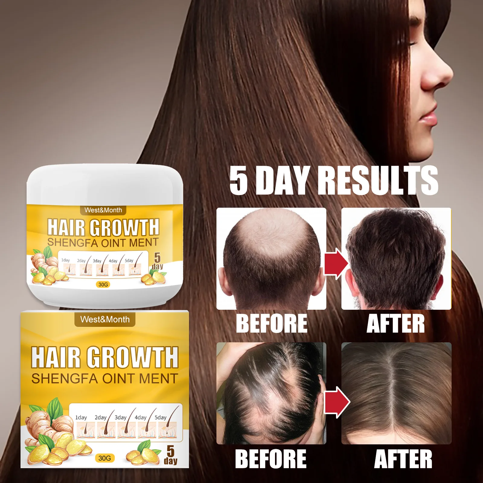 

Fast Hair Growth Serum Essential Oils Ginger Treatment Hair Loss Essence Nourishing Soften Scalp Repair Damaged Hair Care Tools