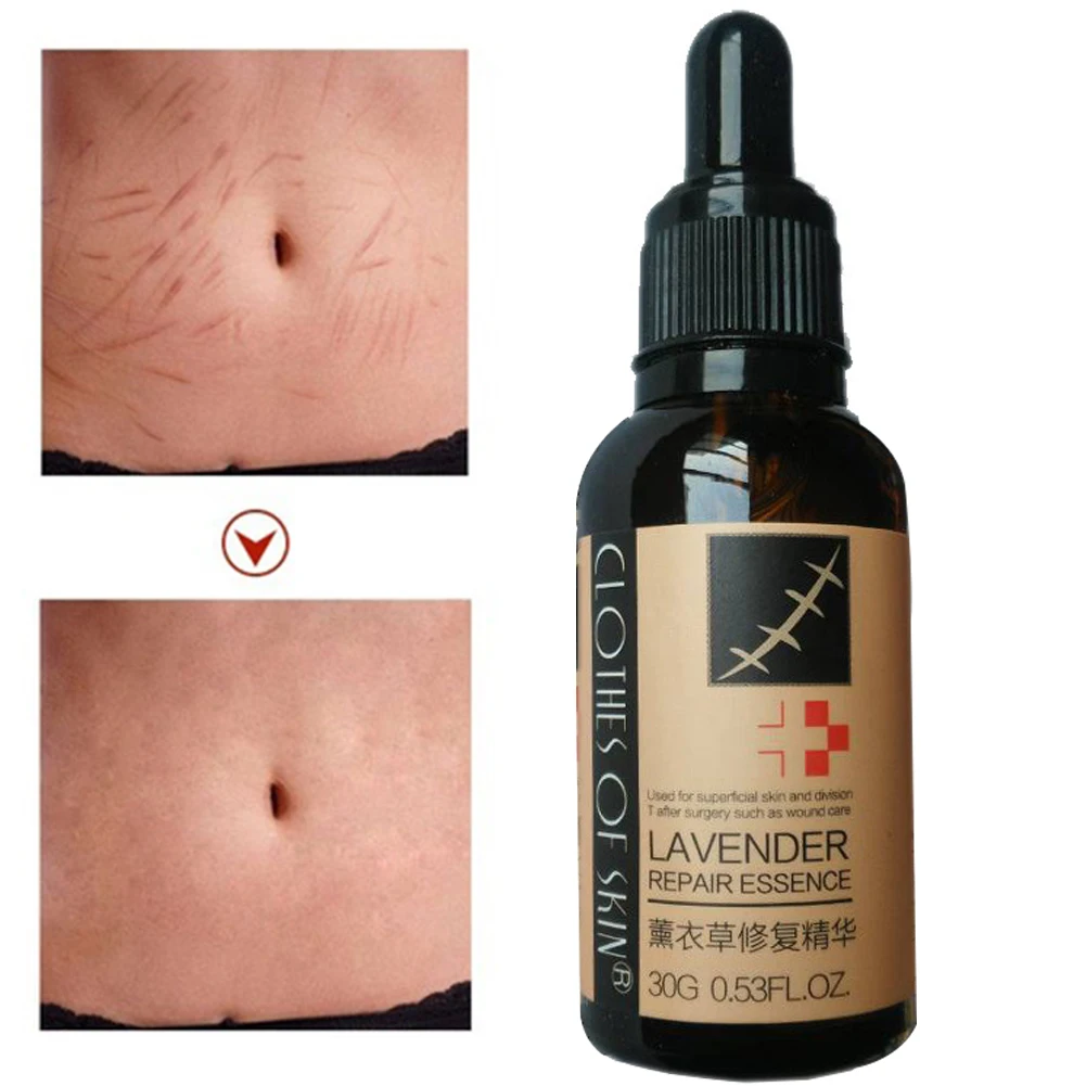 Лечение гладкой кожи восстановление эссенция для ухода за кожей лаванда дезальт