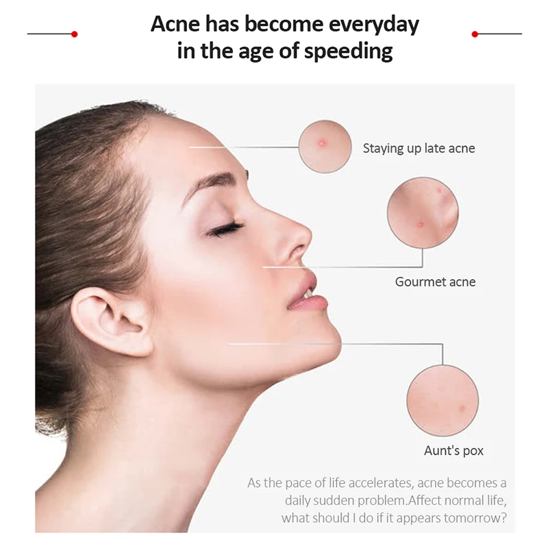 Лазерная ручка для лечения пятен и прыщей портативный аппарат удаления морщин с