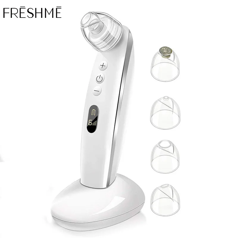 Средство для удаления черных точек FRESHME для лица, средство для удаления глубоких пор и прыщей