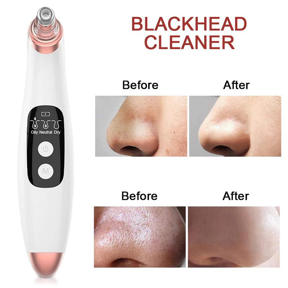 

Nose Pore Acne Pimple Removal Cleaner Facial Skin Blackhead Remover Extractor Clean Exfoliating Instrument Spot Cleaner