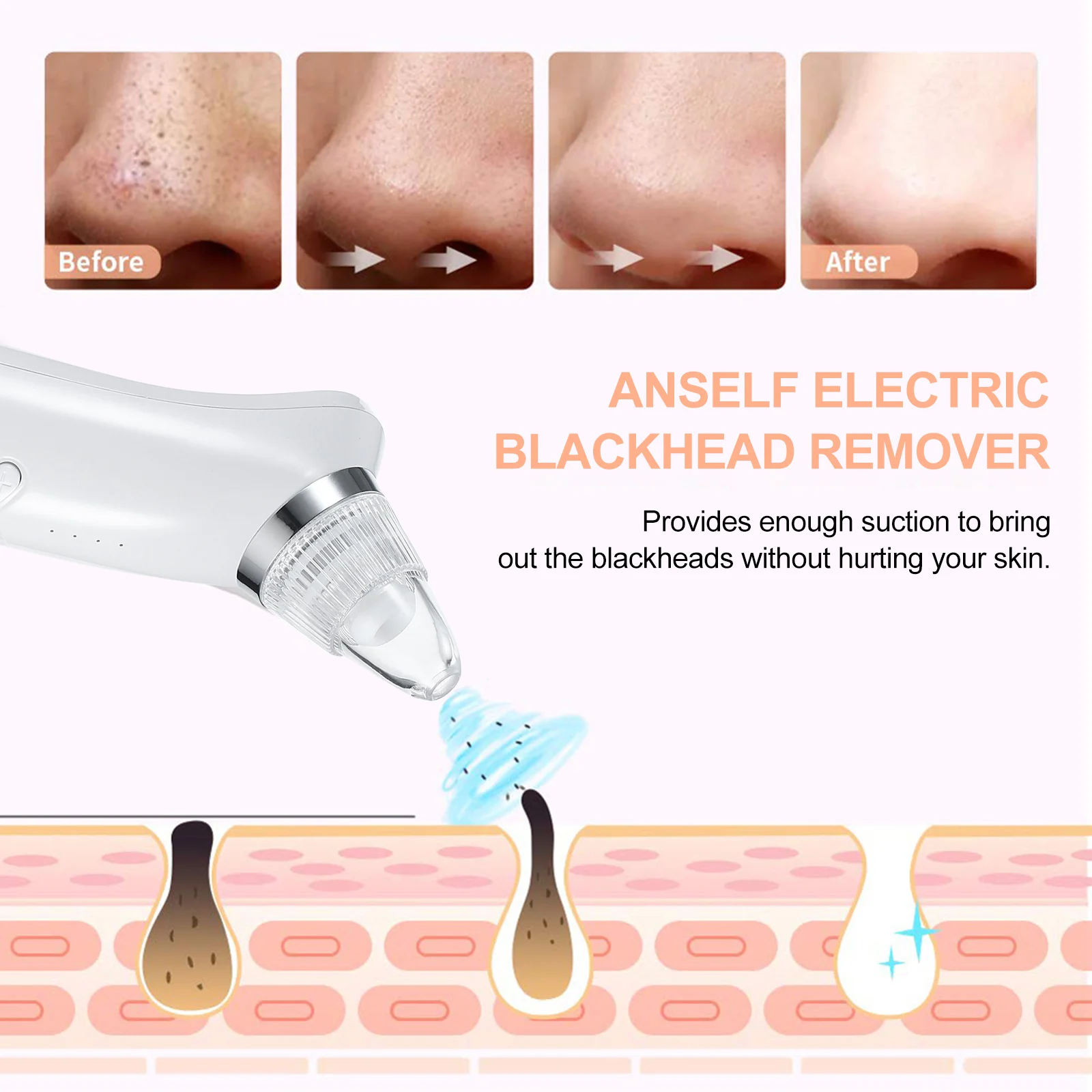 

Anself Electric Blackhead Remover Vacuum Facial Pore Cleanser Acne Comedone Extractor Rechargeable Blackhead Suction Tool