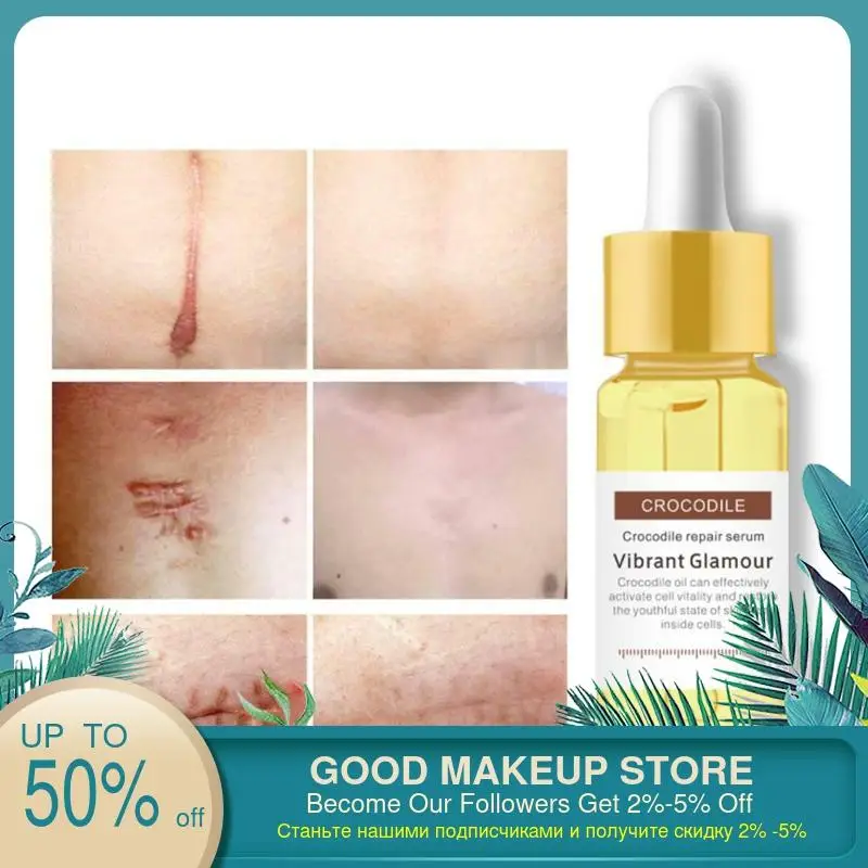 VIBRANT GLAMOUR Crocodile Repair Scar Face Serum Removal Acne Whitening For Spots Treatment Stretch Marks Skin Care | Красота и