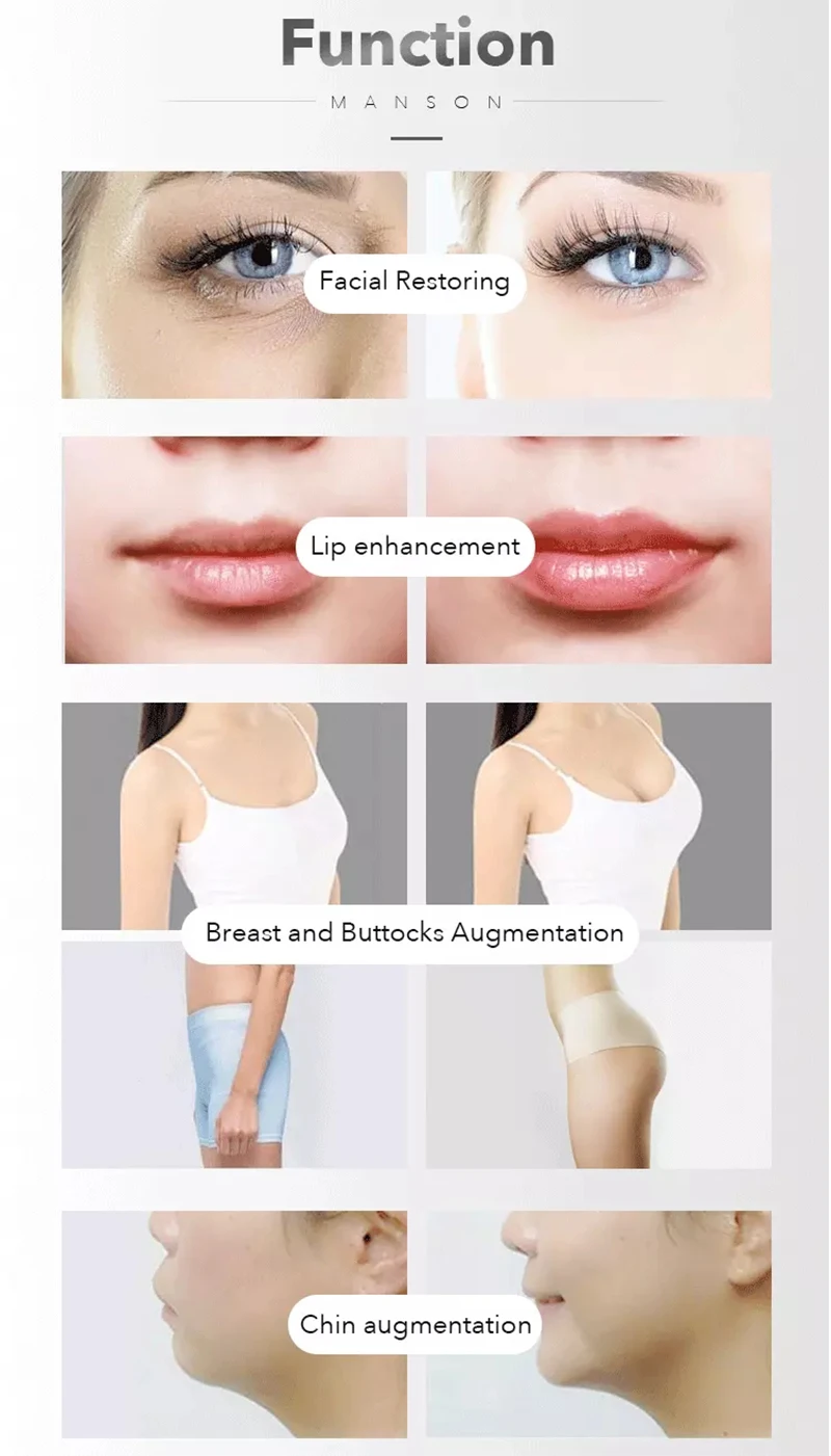 1 шт., 2 мл, наполнитель гиалуроновой кислоты, кожный наполнитель для губ, против морщин, лифтинг для лица, гиалуроновая ручка, распылитель, Пистолеты для инъекций