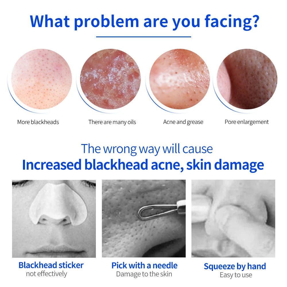 Новинка средство для удаления черных точек лица прыщей пор ухода за кожей