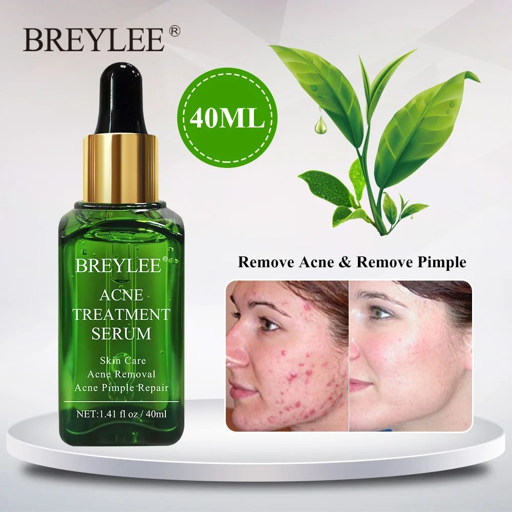 

BREYLEE Tea Tree Acne Treatment Face Serum Reduce Acne Scars Essence Oil Control Moisturizer Brighten Shrink Pores Skin Care
