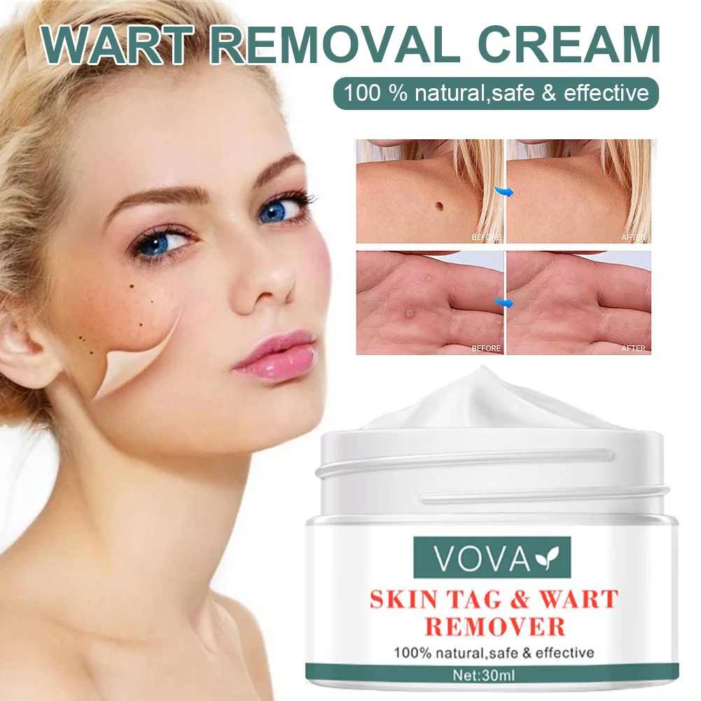

30ml Skin Tag & Wart Removal Cream Fast Acting Natural Ingredients Wart Repair Treatment Cream for Face Body for All skin types