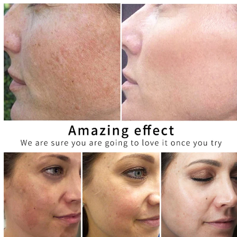 LANBENA Золотая шелковая ампула коллагена сыворотка удаляет меланин осветляет