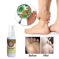 60ml feet spray non irritating no sting skin care beriberi itch feet deodorizer long lasting for men