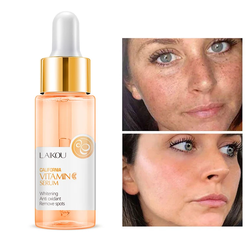 

Vintamin C Serum Antioxidant Brighten Skin Face Essence Ascorbic Acid Reduce Spots Even Skin Tone Whitening Skin Care Liquid