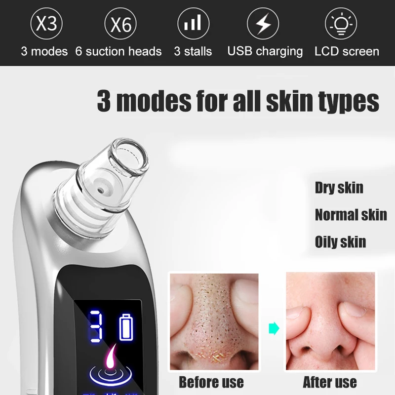 

Hot sale Electric Facial Nose Pore Vacuum Cleaner Blackhead Acne Remover Skin Care Beauty Tool
