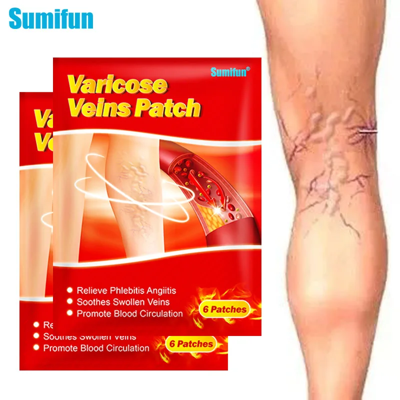 

Sumifun 6/12Pcs Varicose Veins Treatment Blood Vessel Swelling Itching Leg Numbness Vasculitis Phlebitis Angiitis Plaster Patch