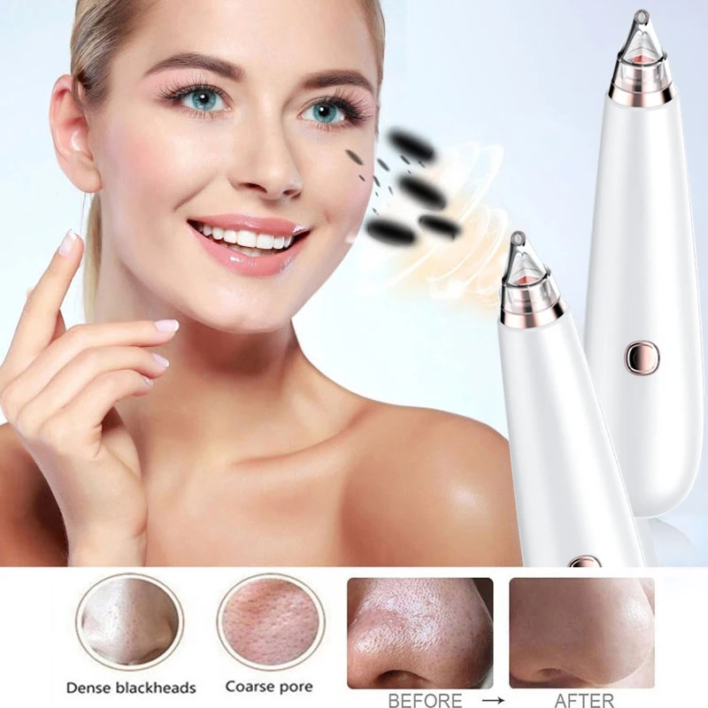 Средство для удаления черных точек вакуумное оборудование косметический