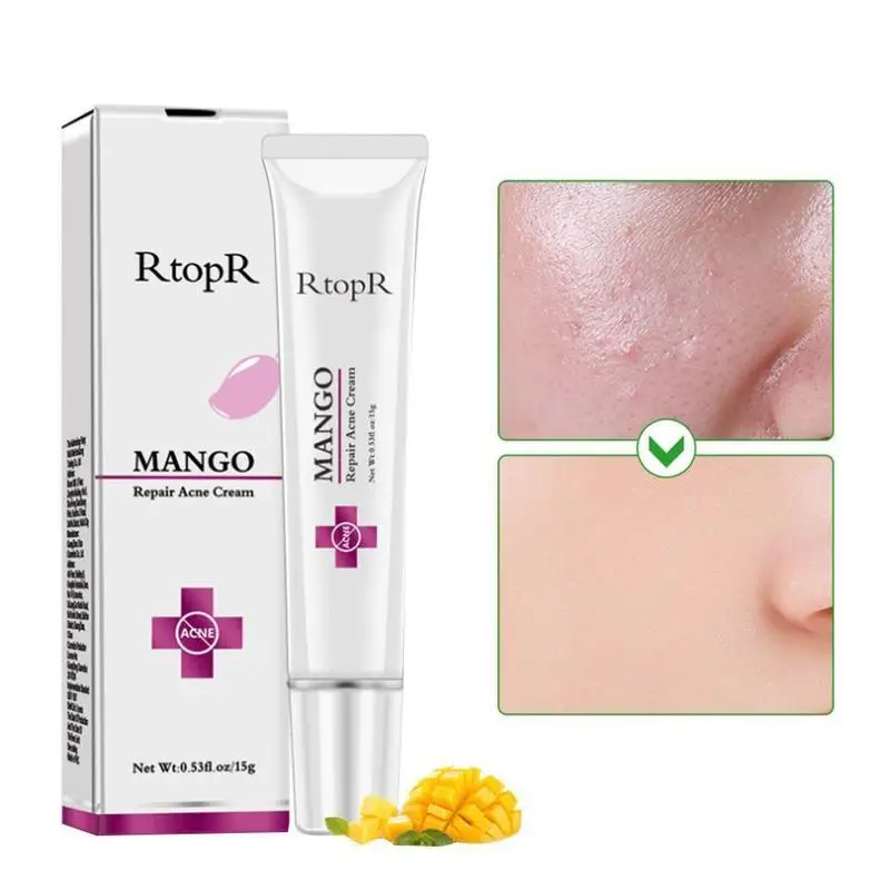 

Mango Repair Acne Cream Anti Acne Spots Acne Treatment Scar Blackhead Cream Shrink Pores Whitening Moisturizing Face Skin Care