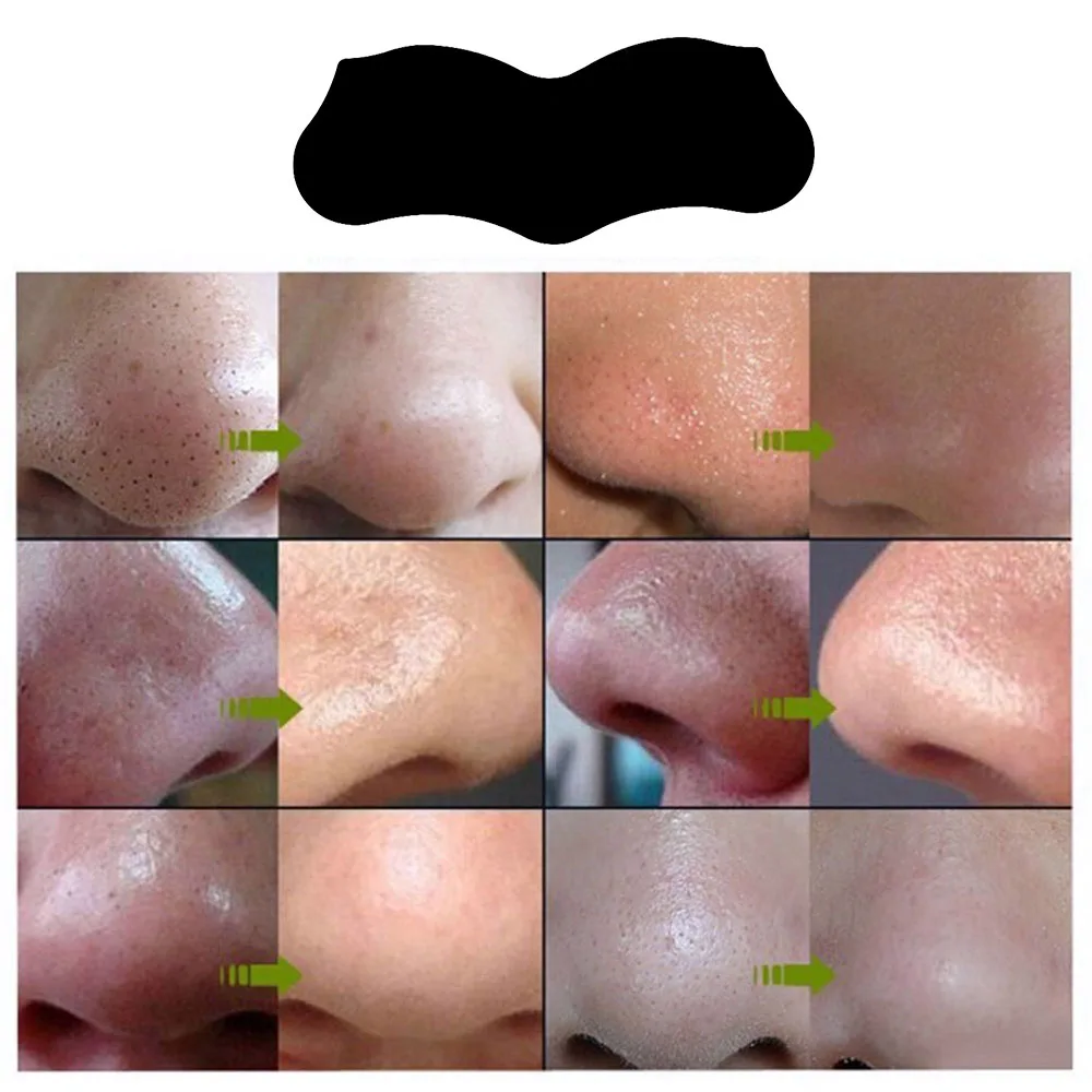 10 шт. маска для ухода за кожей лица удаления черных точек акне прозрачная 3 шага