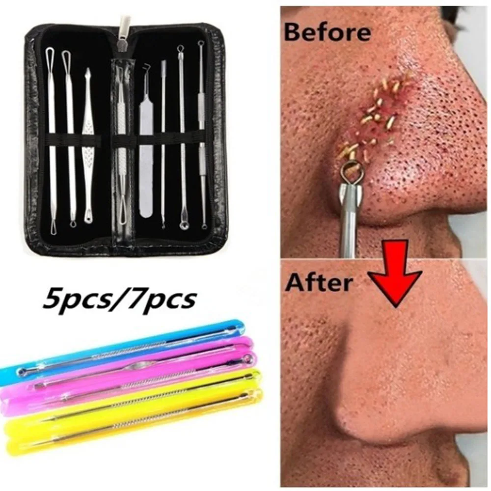 | Инструмент для удаления точек комедонов угрей пожеланий набор акне экстрактор