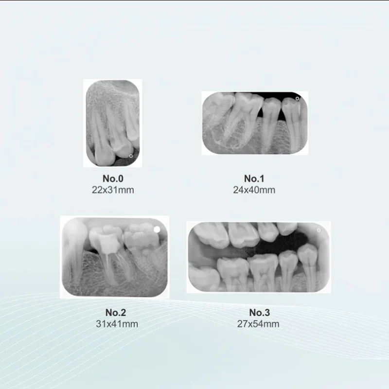 

Dental Image Plate IP PSP Phosphor Plate for Dental CR Imaging Scanner System Dentistry Materials Size 0 Size 1 Size 2 Size 3