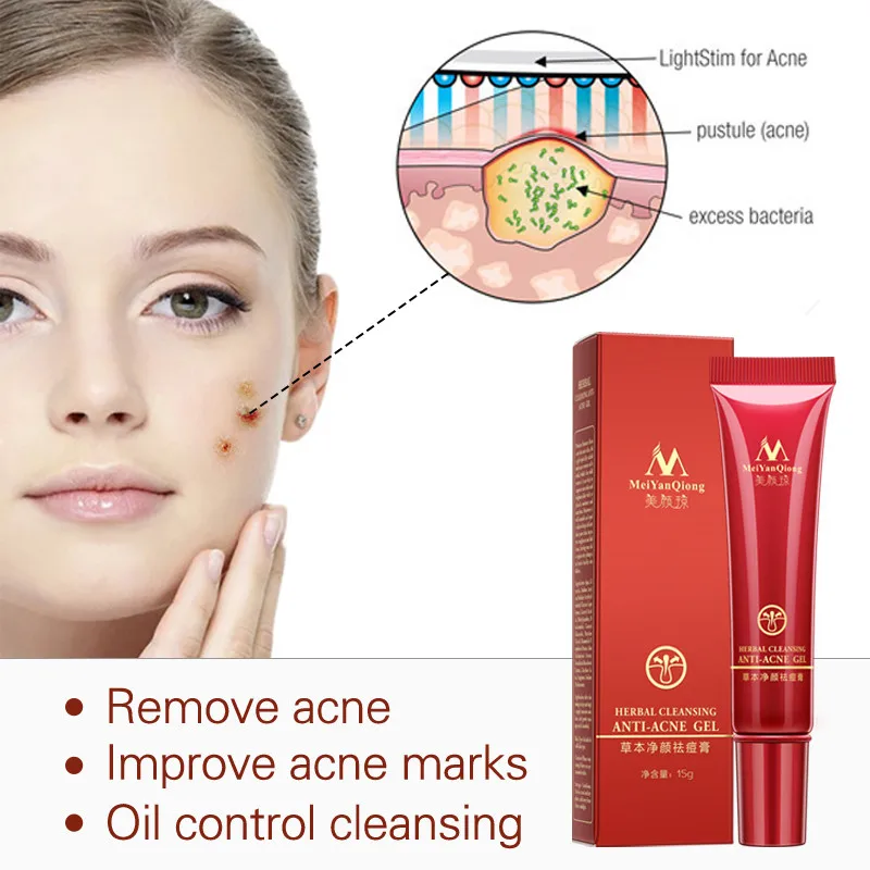 MerYanQiong Acne Treatment Gel Remove Pimples Face Scars Cream Anti Removal Shrink Pores Whitening | Красота и здоровье