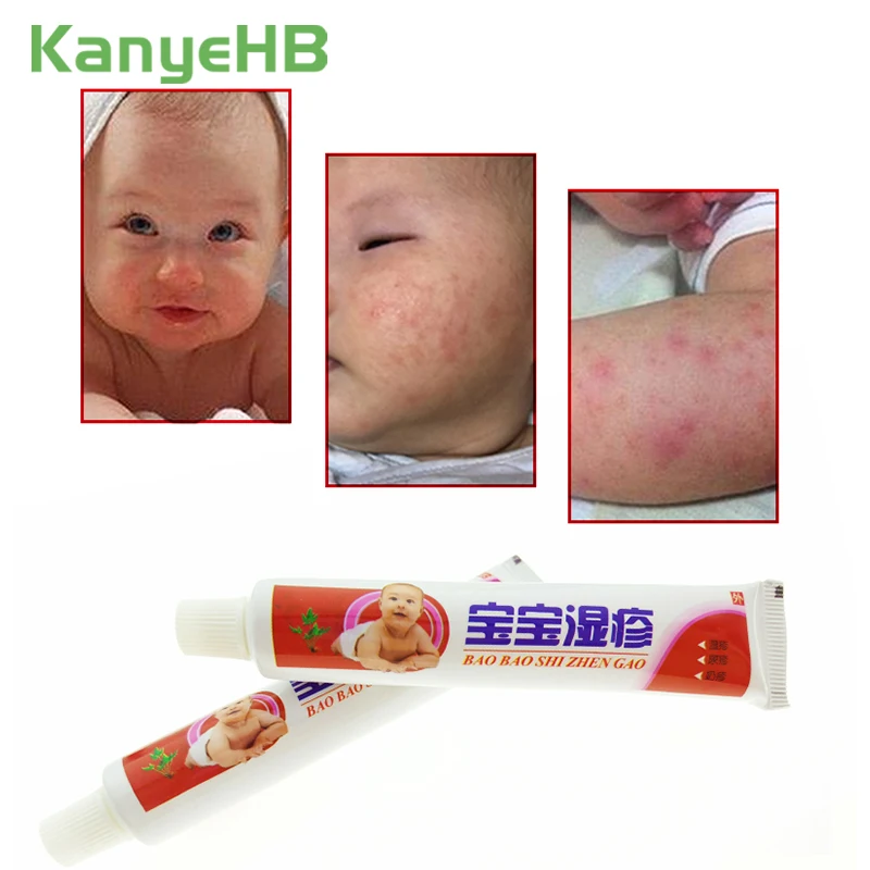 1 шт. Детский Крем в виде экземы псориаз зуд ремонт кожи китайский травяной