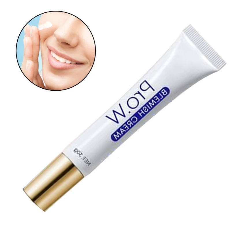 30g Face Blemish Freckle Cream Pimple Acne Treatment Scar Dark Spots Removal U2JD
