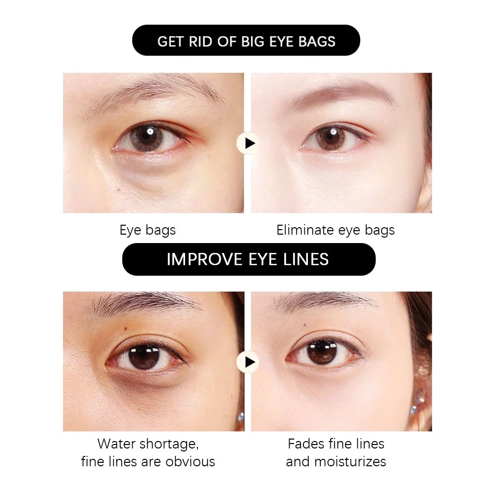 Кокосовая гидрогелевая маска для глаз патчи увлажняющий крем удаление темных