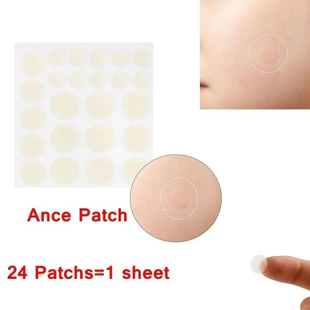 

24/36Pcs Hot Sale Acne Remover Patches Skin Tag Removal Patches Care Acne Patches Makeup Remover Skin P5X0