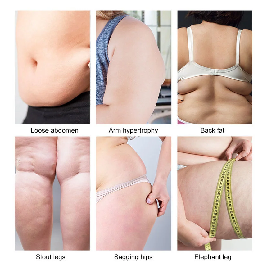 Beste Rf Led Ultrasone Cavitatie Lichaam Afslanken Stimulator Machine Verwijderen Gezicht Rimpel Fat Burner Cellulitis Verwijdering Machine Groothandel