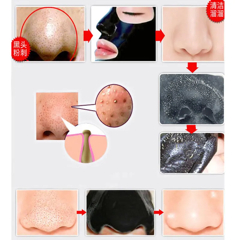 volcanic Blackhead Face Remover Nose Deep Cleansing Acne Treatment Pore Cleanser Black Care Head |