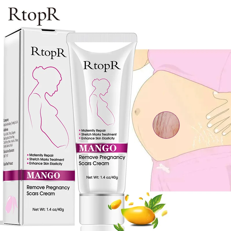 Mango удалить Беременность Шрамы Акне Крем утягивающий Знаки - Цена: 289,18 руб.
