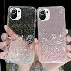 Блестящий чехол со звездами для телефона xiaomi mi 10 10T 10S 11 11pro 11 pro lite 5G, прозрачный чехол для xiaomi mi11, задняя крышка