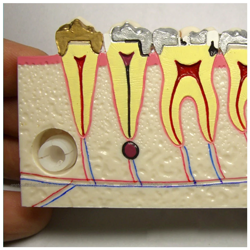 

12591 / Dental Tissue Oral Teeth Study Model Dentist Patient Molar