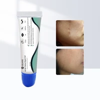 scar removal cream face cream for face acne scar stretch marks remover cream skin repair face cream acne spots 8g