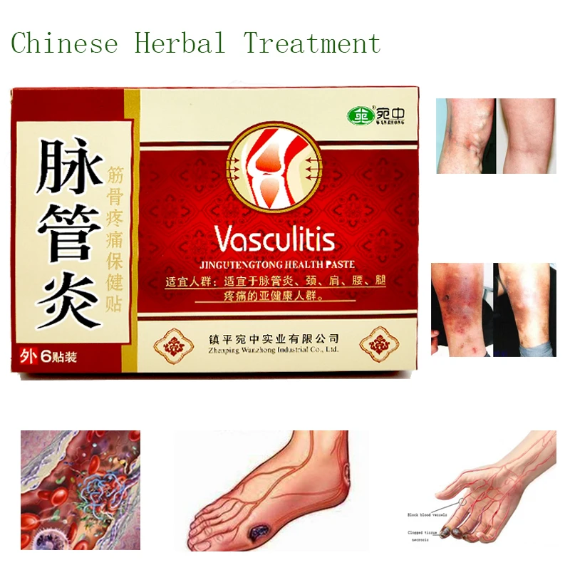 

24PCS Chinese Traditional herbal medicine Patches Cure Spider Veins Varicose Treatment Plaster Varicose Veins Vasculitis TC79464